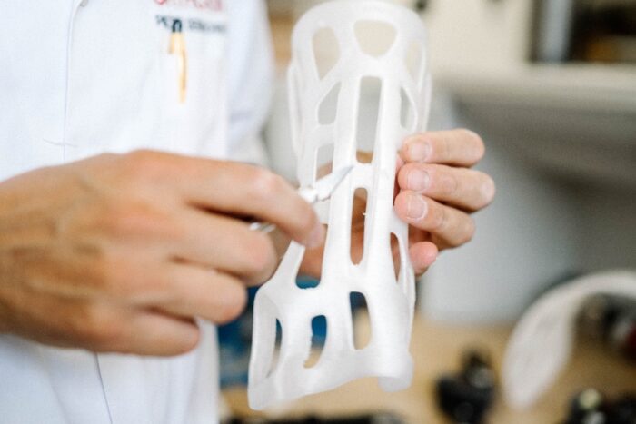 A doctor refining a 3D printed cast for a patient